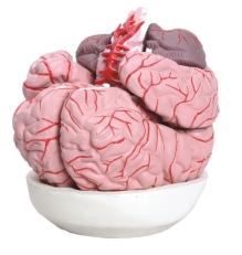 cerebro com arterias tzj 0303 a